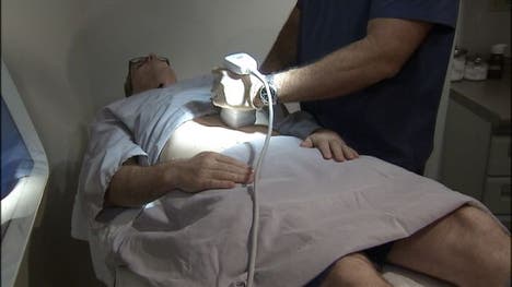 Liposonix, a new ultrasound technology, helps to zap away the last bit of fat leftover after exercising and eating right.
